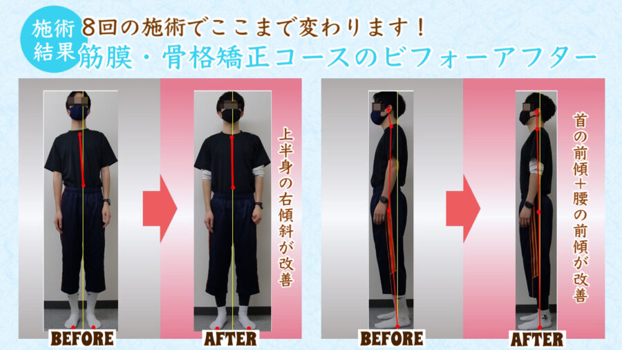 施術前後の変化
