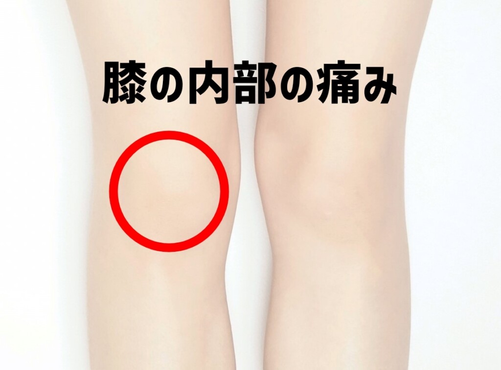 膝の内部の痛み