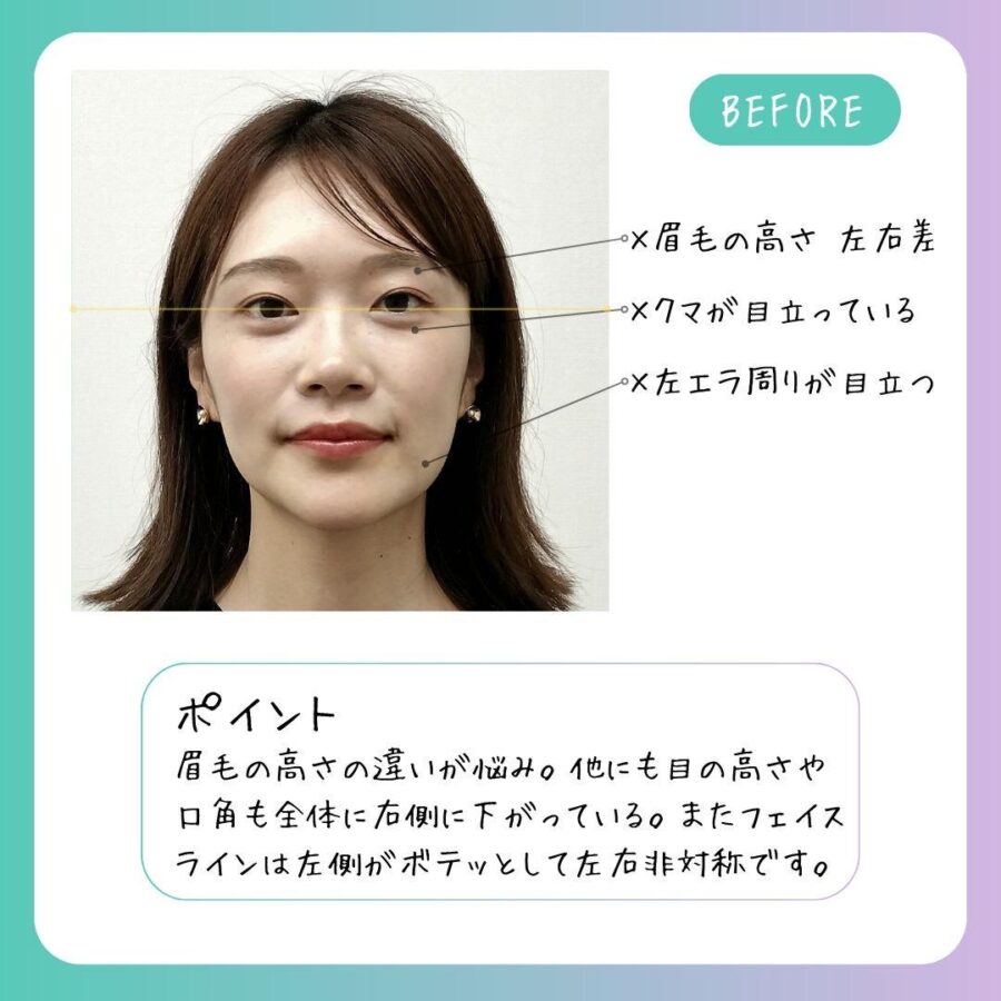 小顔整体 施術前