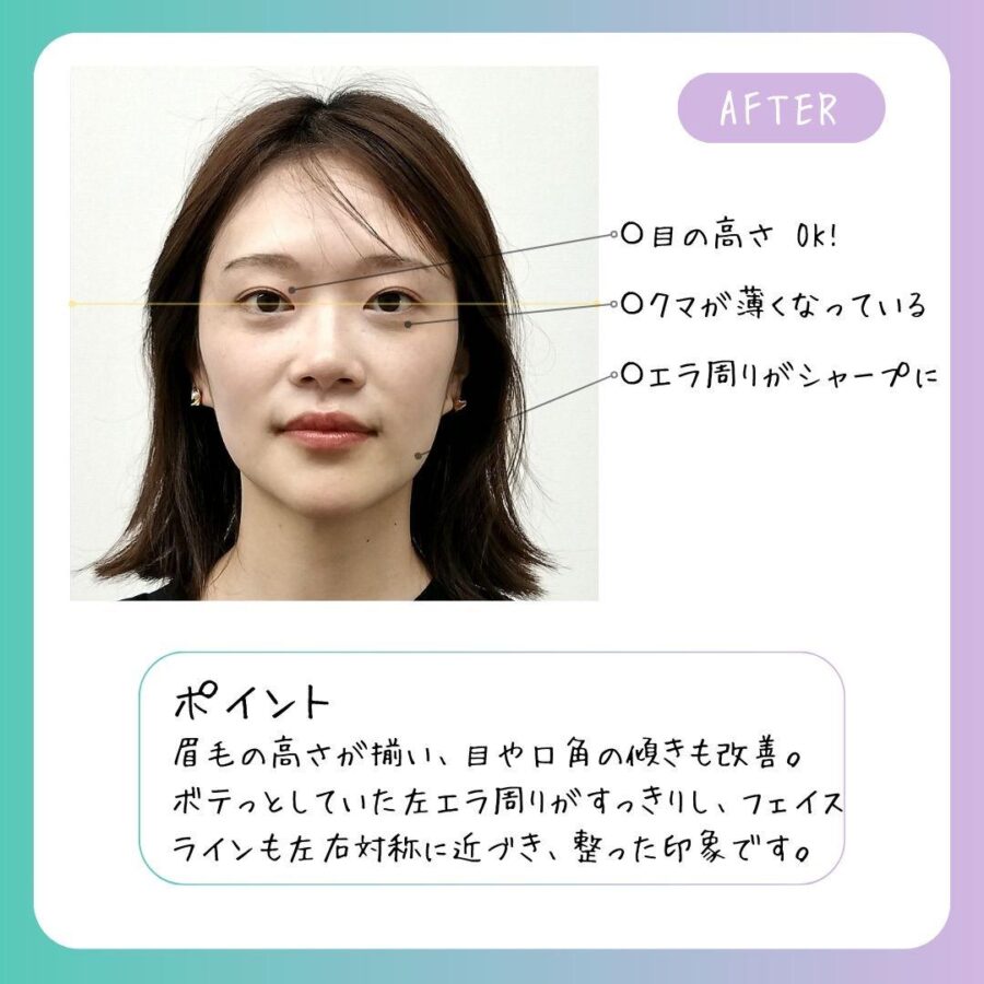 小顔整体 施術後