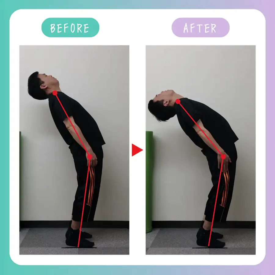 自由が丘あゆむ整体院の施術前後比較。整体前と整体後で身体の反りや姿勢バランスが改善し、柔軟性と可動域が向上した様子