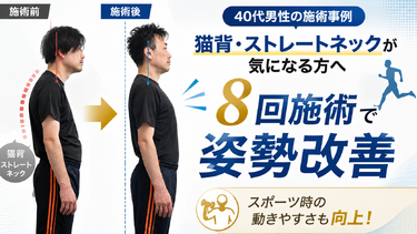 【症例紹介】猫背・ストレートネックが気になる40代男性｜姿勢改善とスポーツパフォーマンス向上のケース