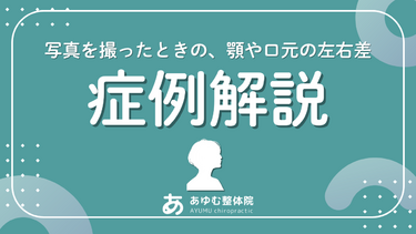 【症例紹介】写真で気づく顎・口元の左右差／顎の痛み・違和感が改善した40代女性（1回目）