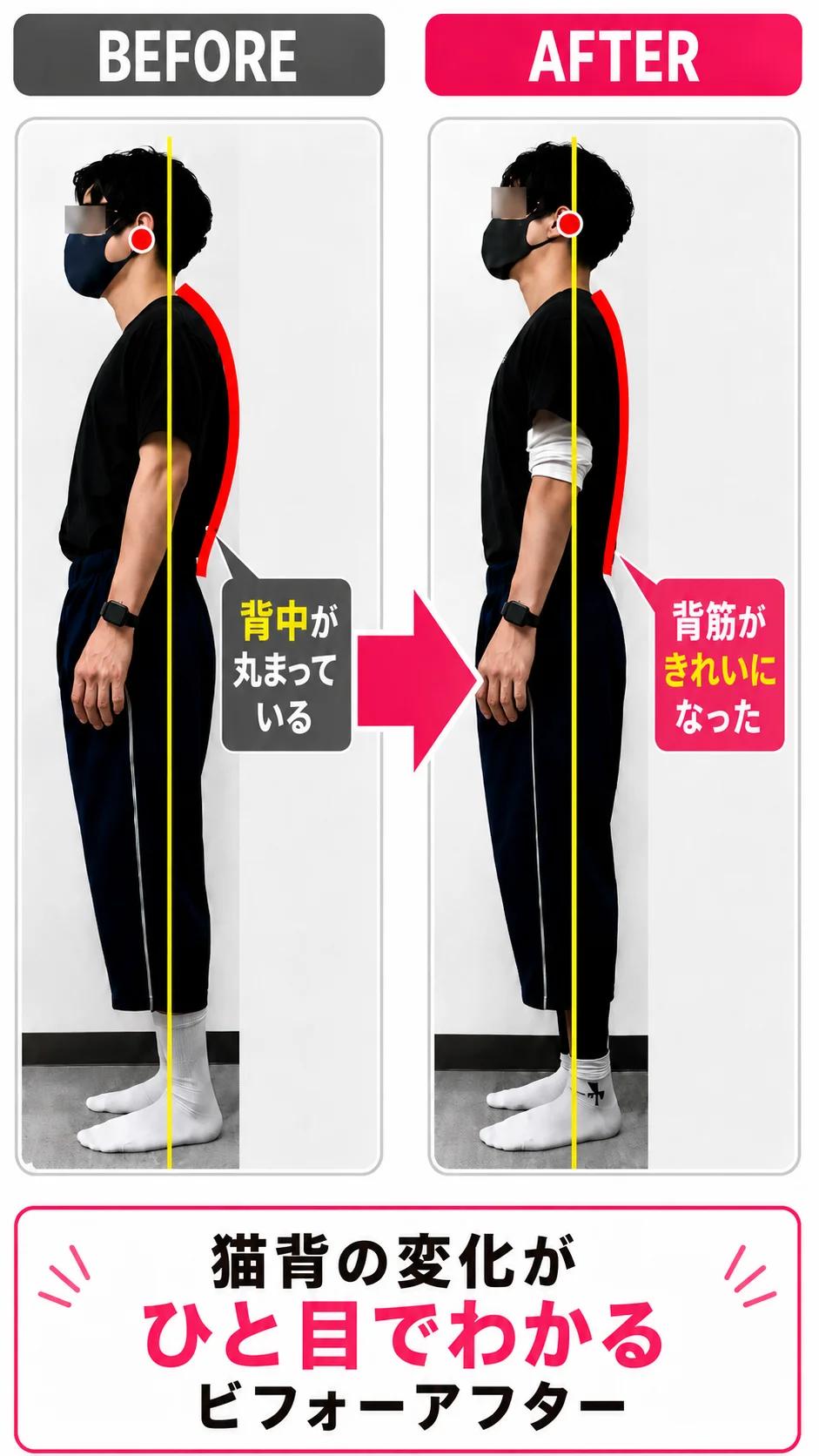 猫背による背中の丸まりが変化した姿勢比較イメージ