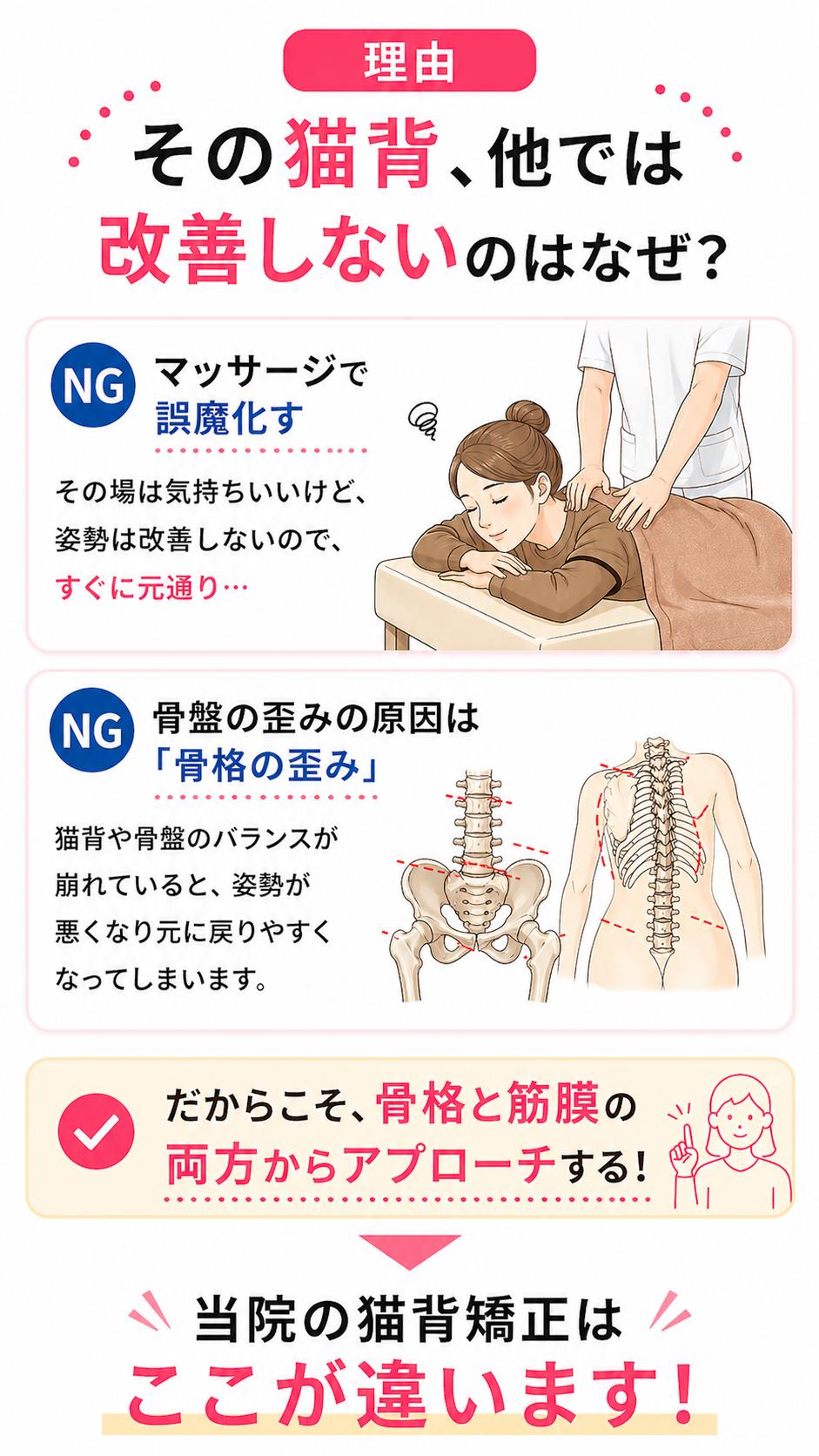 猫背改善のための骨格と筋膜バランスについて解説した画像