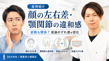 【症例紹介】顔の左右差・顎関節の違和感は姿勢も関係？前歯のずれ感が変化した30代男性