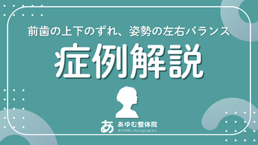 【症例紹介】顔の左右差・顎関節の違和感は姿勢も関係？前歯のずれ感が変化した30代男性