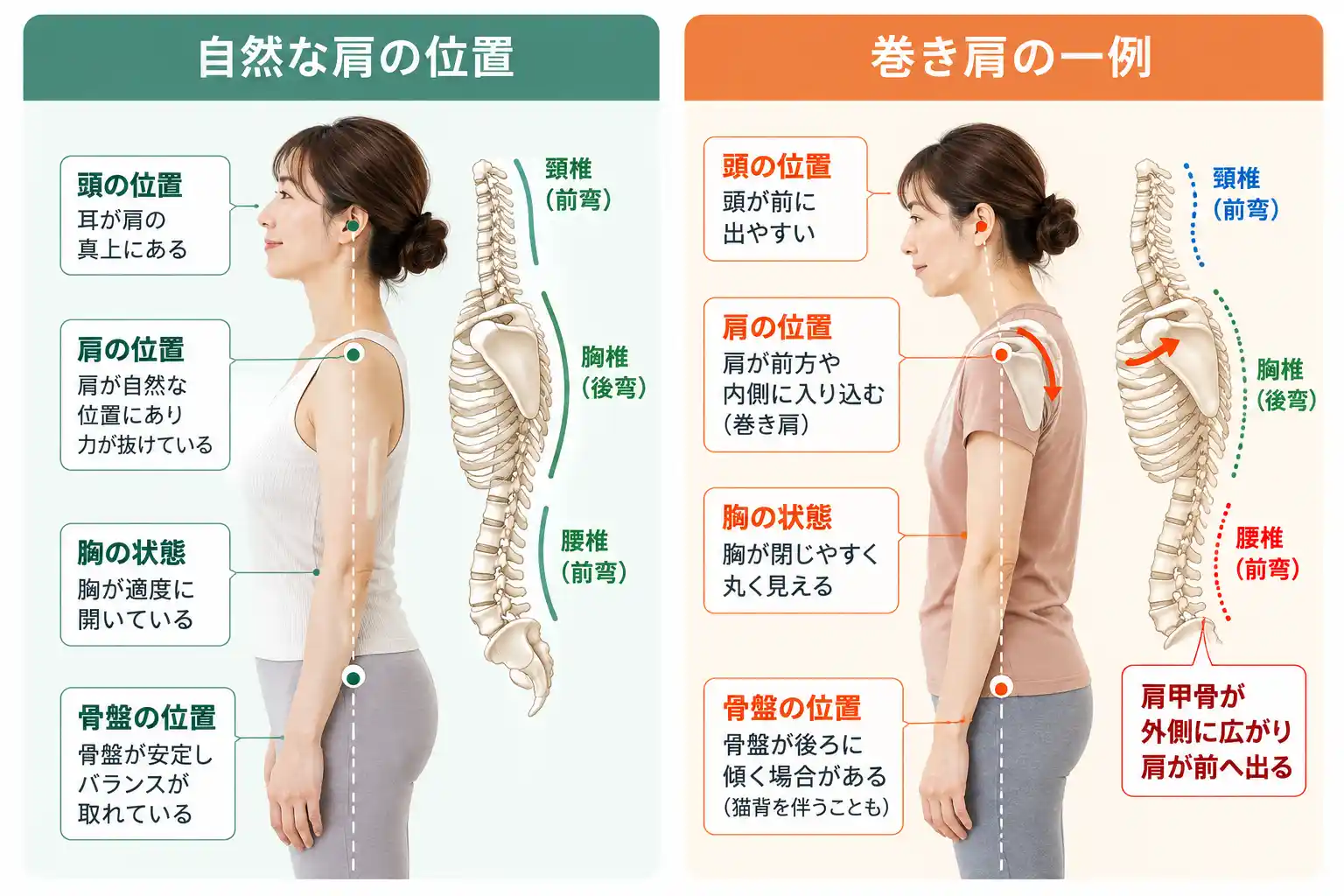 自然な肩の位置と巻き肩の状態を比較した図解。女性の横向きの姿勢と背骨・肩甲骨のイラストを用いて、頭や肩の位置、胸の開き方、骨盤の傾きの違いを説明。