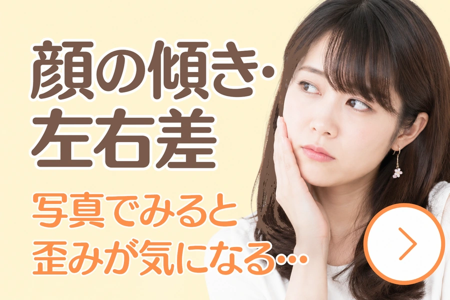 顔の傾きや左右差についての案内画像。頬に手を添えた女性と、「写真でみると歪みが気になる」という悩みを示している。